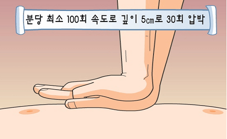 가슴을 압박하는 방법에 대한 설명